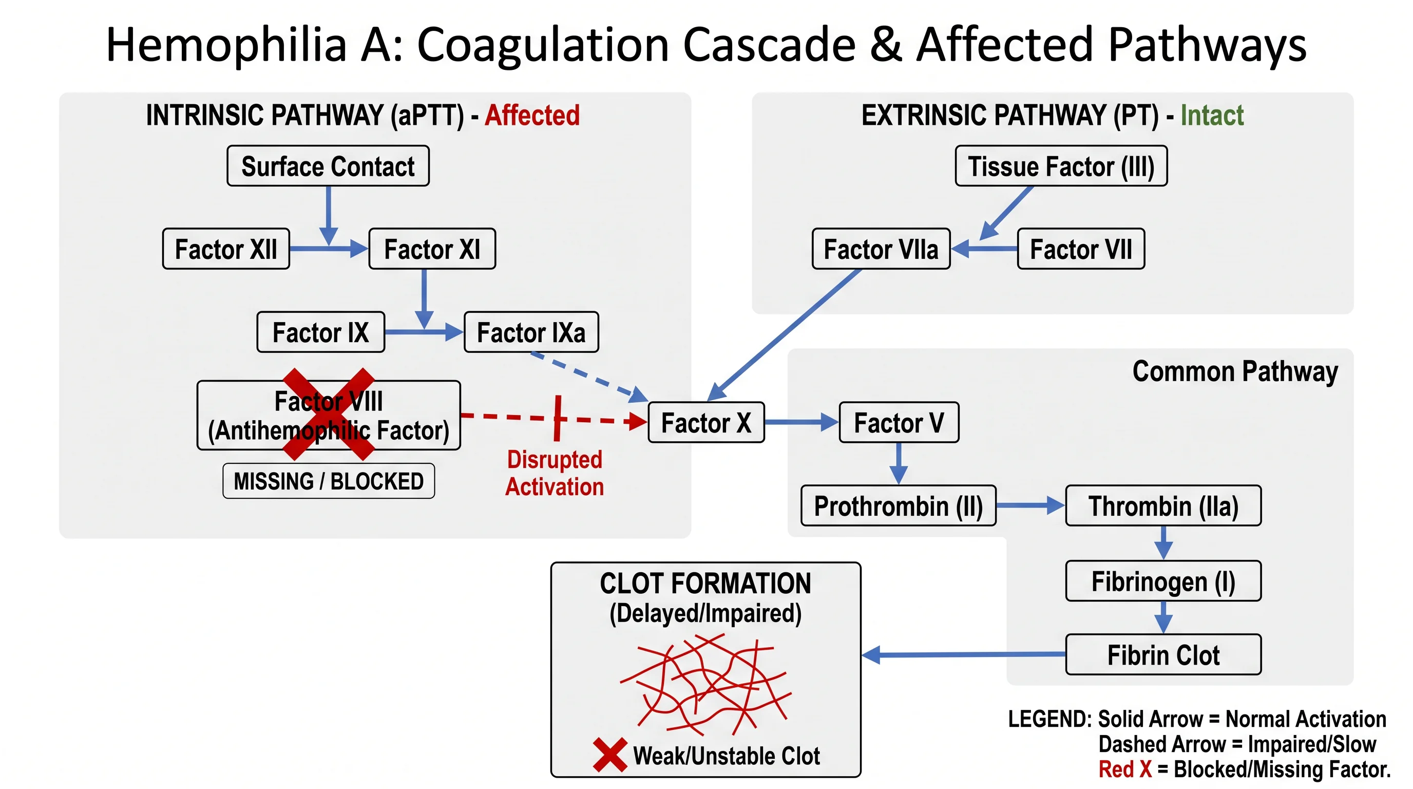 Coagulation cascade diagram highlighting Factor VIII as missing in hemophilia A, with the intrinsic aPTT pathway affected and the extrinsic PT pathway intact