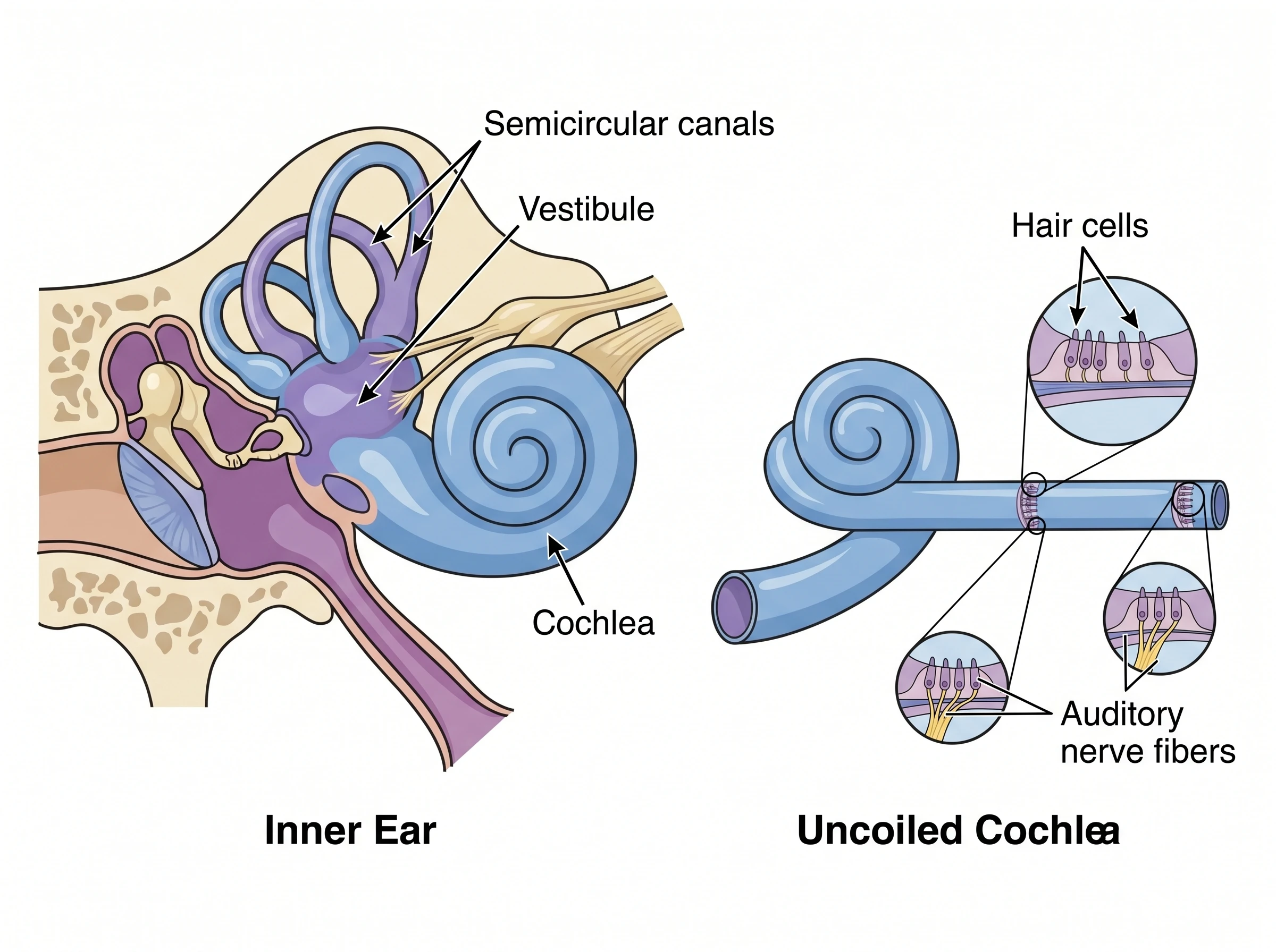 A detailed diagram of the inner ear showing the cochlea, semicircular canals, and vestibule, labeled