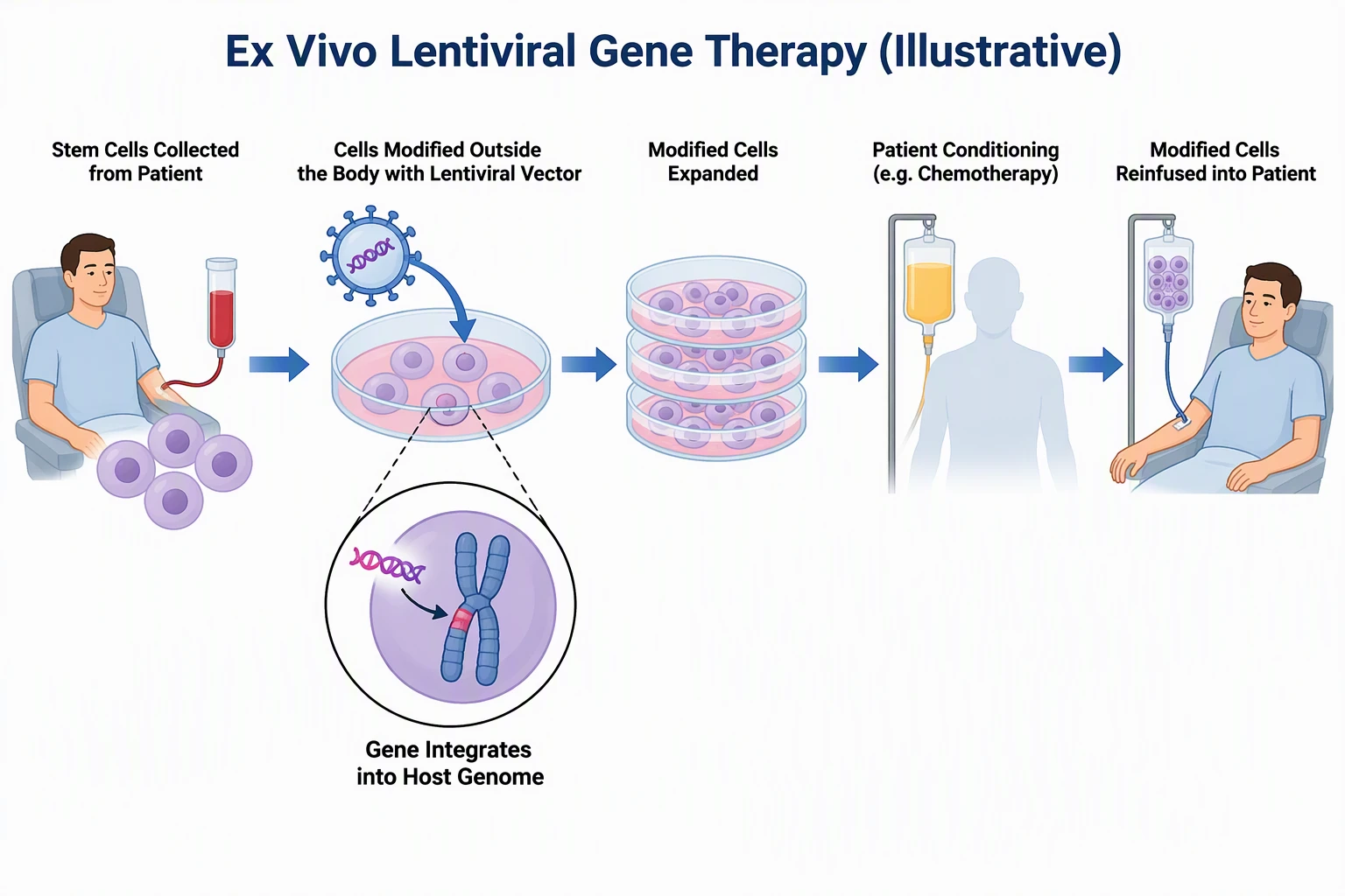 AI-generated ex vivo lentiviral gene therapy diagram: stem cells collected, modified outside the body, gene integrates into host genome, expanded, conditioning, reinfused