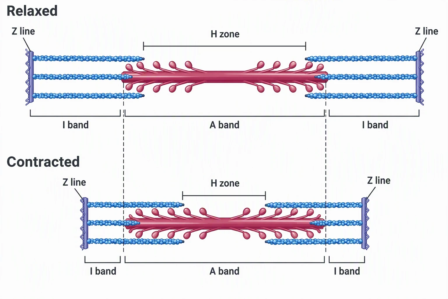 Two-row sarcomere diagram labeled Relaxed on top and Contracted below, each with Z line (two), I band (two), A band, and H zone