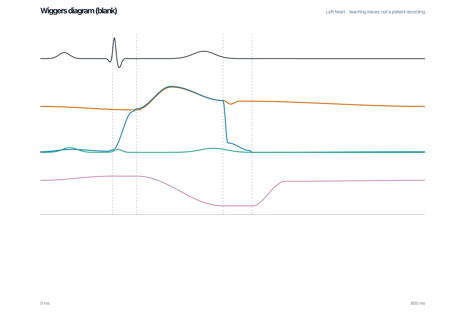 Blank Wiggers diagram worksheet with stacked cardiac-cycle axes and no curve names for students to label valve events and heart sounds