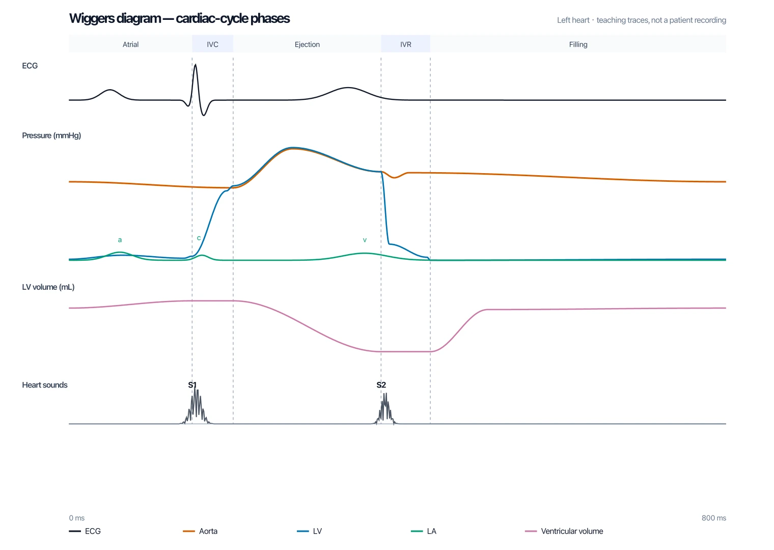 Wiggers diagram with colored bands for atrial systole, isovolumetric contraction, ejection, isovolumetric relaxation, and ventricular filling