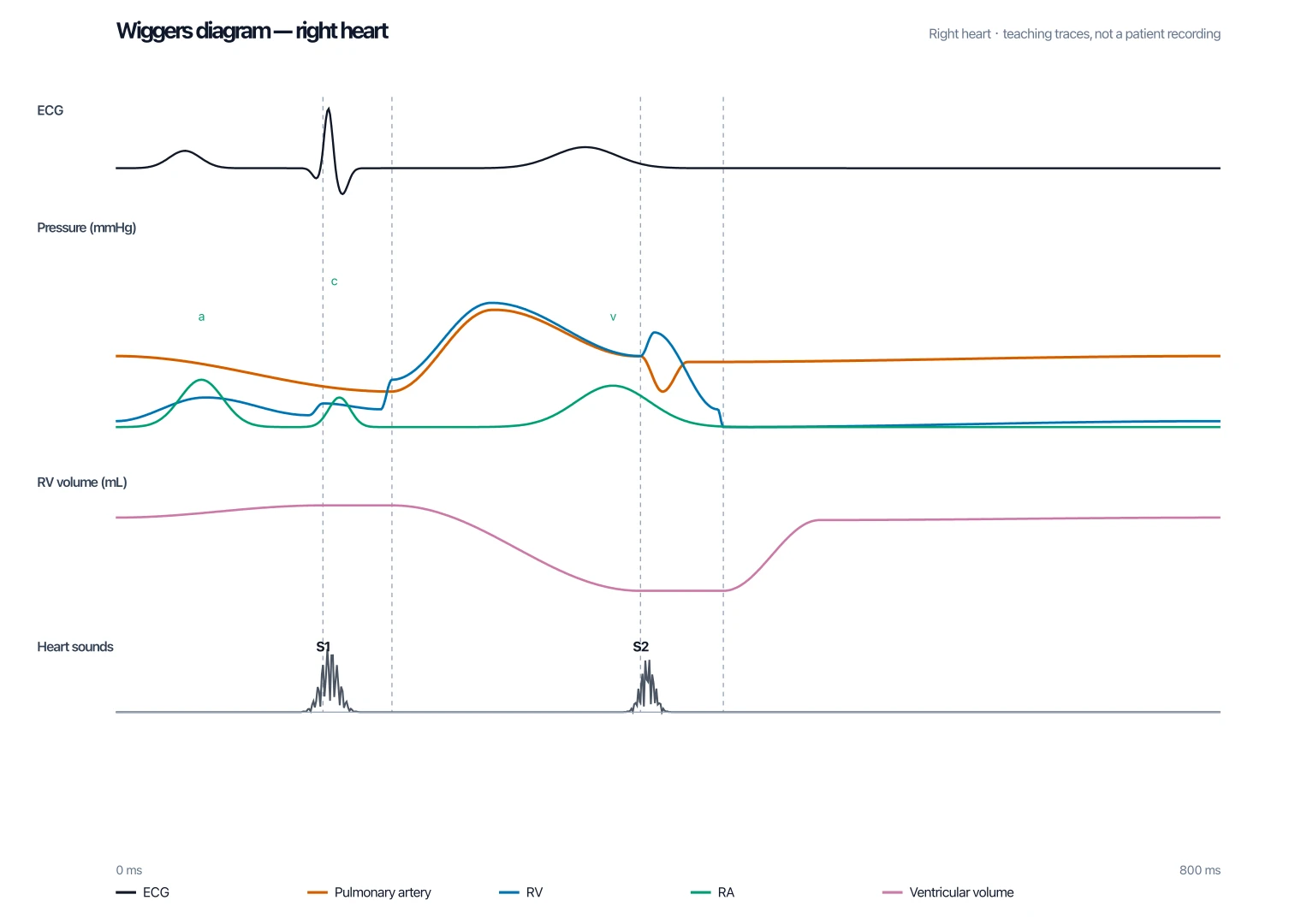 Right-heart Wiggers diagram with pulmonary-artery, RV, and RA pressures on a lower mmHg scale plus ECG, volume, and heart sounds